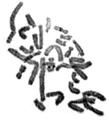 Рис. 4. Метафазна пластинка (26 хромосом) з Ag‑окрашеними РЯОFig. 4. Metaphase plate (26 chromosomes) with silver nitrate stained NORs