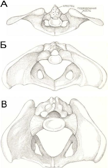 ris 2